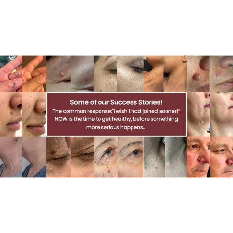 DermiClear™ — Effacez les imperfections de la peau rapidement pour une confiance lisse et radieuse