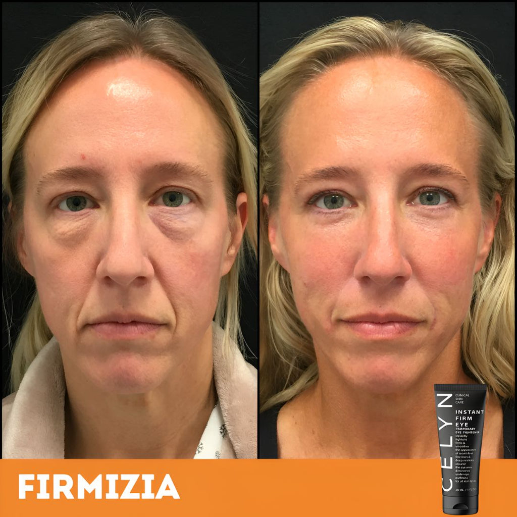 Firmizia™ - Crème anti-rides et cernes instantanée