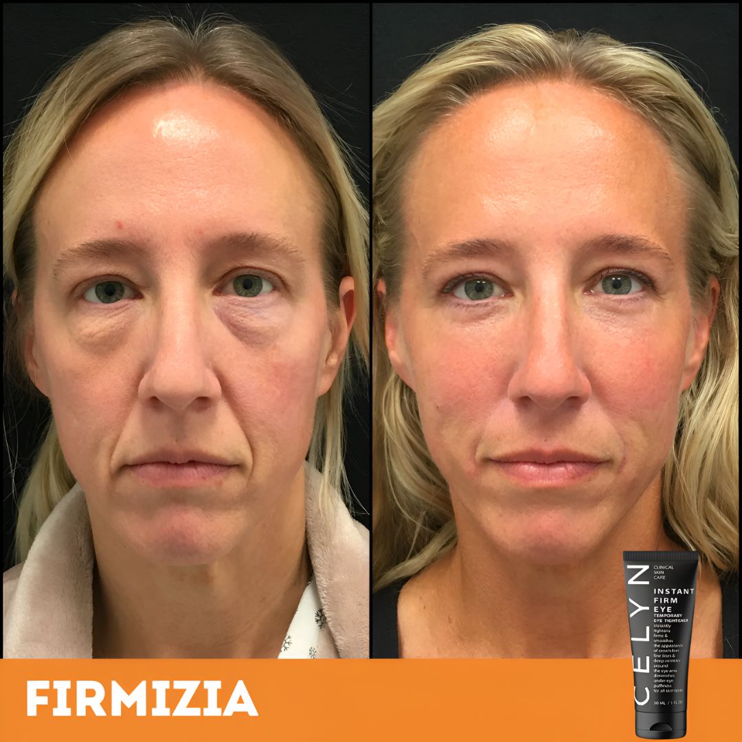 Firmizia™ - Crème anti-rides et cernes instantanée