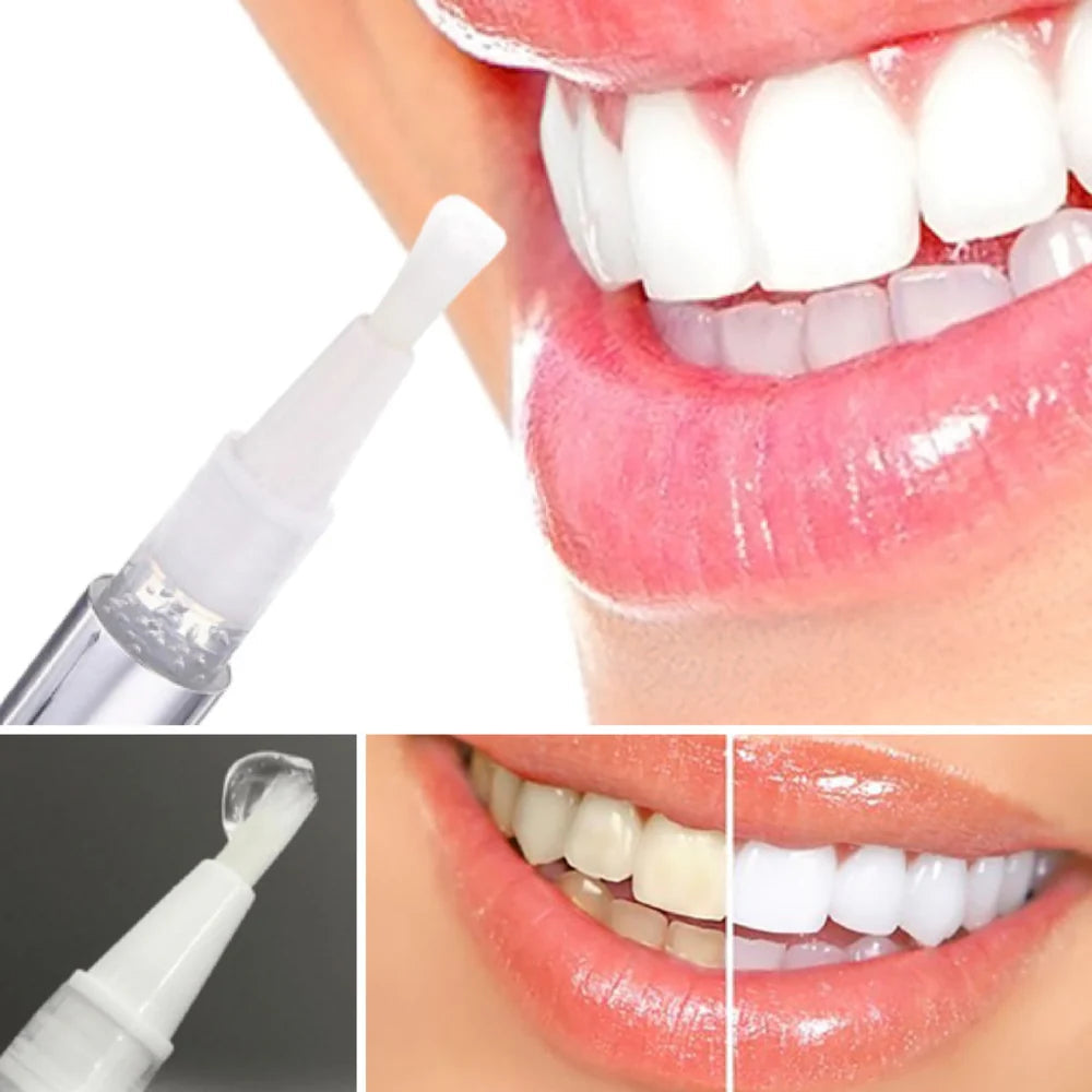 RadianceRush™ — Illuminez Chaque Pièce avec un Sourire Qui Rayonne de Confiance