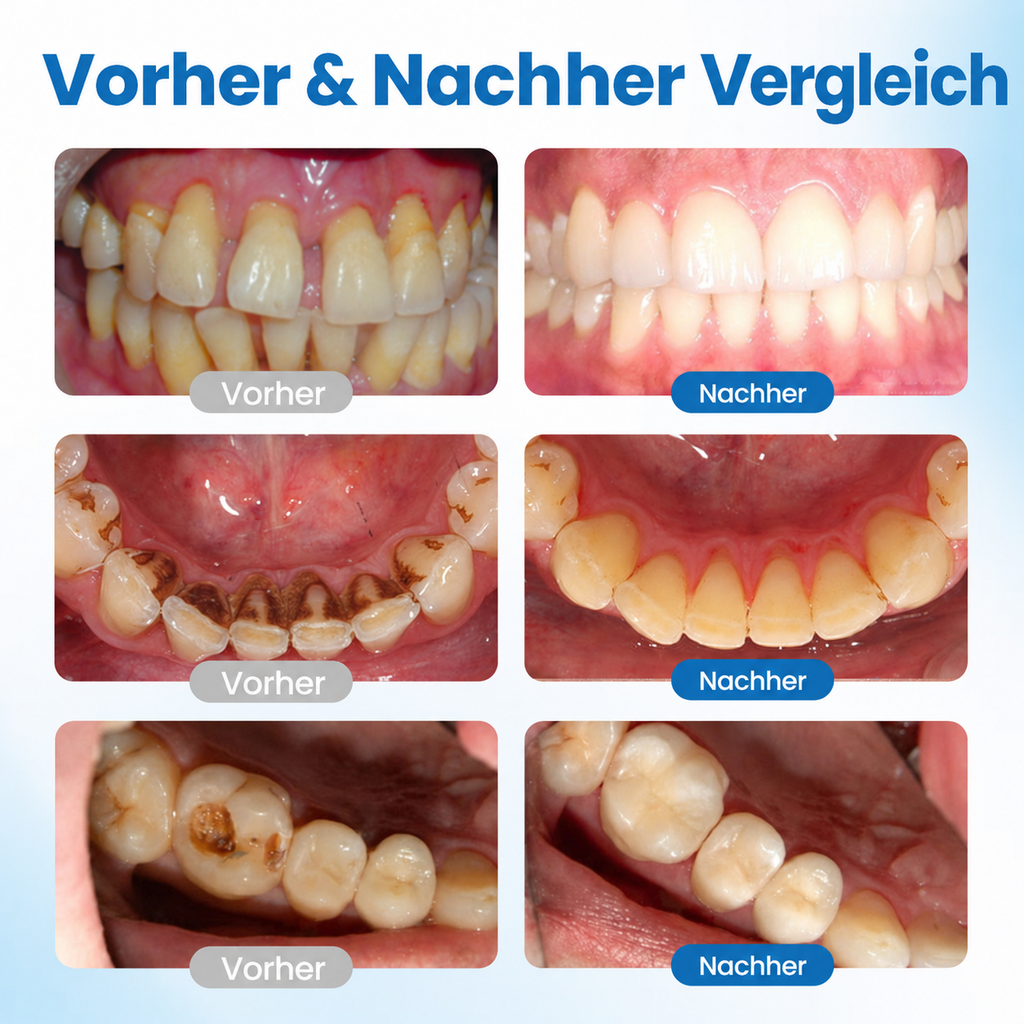 LBMLB™ | NanoHAP Sérum de Protection Dentaire