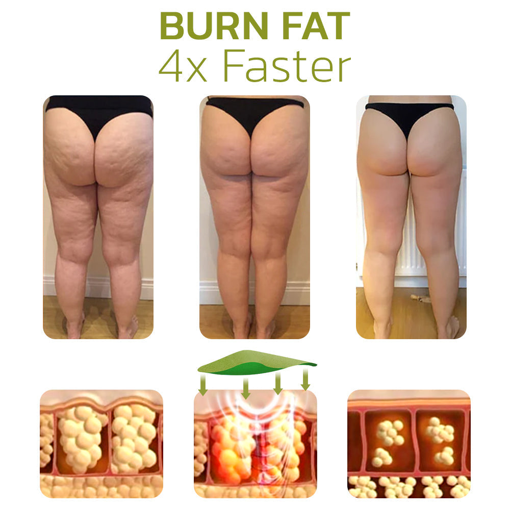 Patch pour Réduire la Cellulite - Formule Naturelle