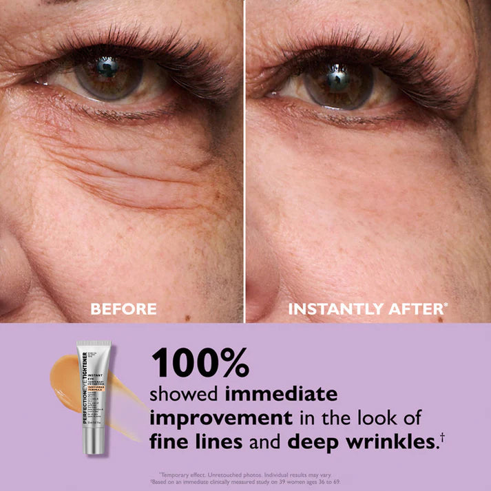 Crème Contour des Yeux Nourrissante | Contre les Cernes & Rides | Regard Frais Instantané