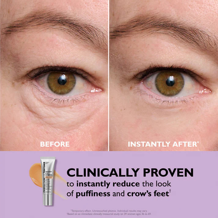 Crème Contour des Yeux Nourrissante | Contre les Cernes & Rides | Regard Frais Instantané