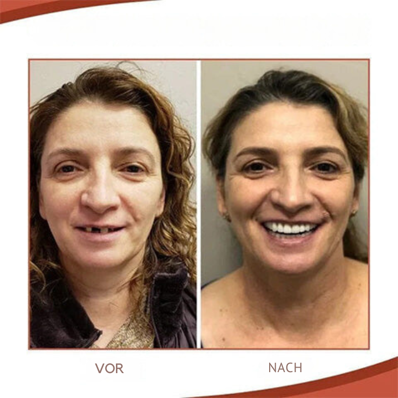 Prothèses dentaires | Ajustement sécurisé et sourire naturel