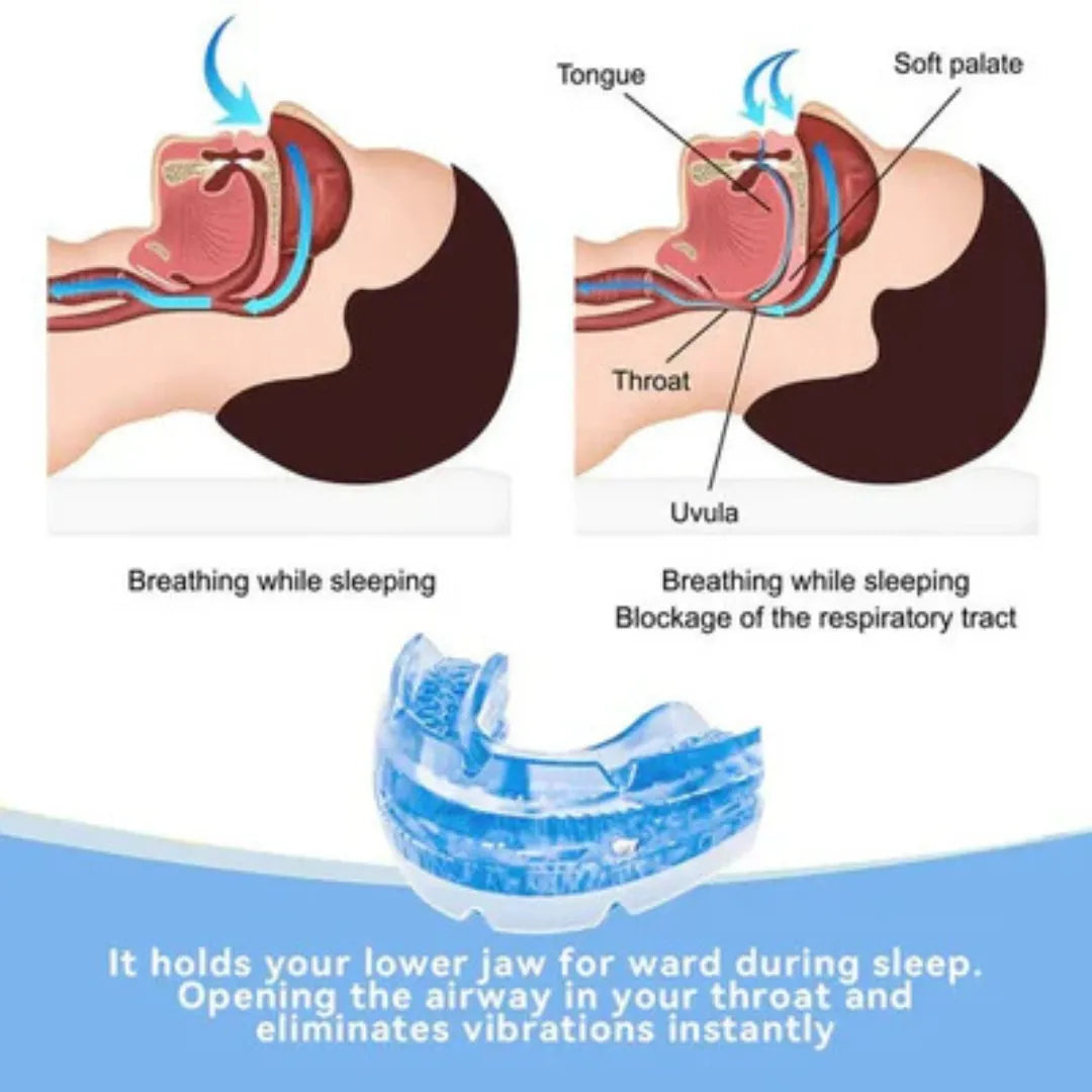 SleepEase - Anti Ronflement pour un Meilleur Sommeil - Embout Réglable pour des Nuits Calmes