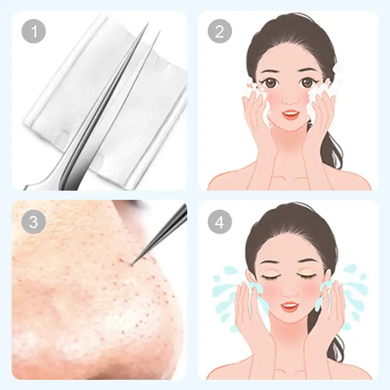 FacialTools - Ensemble d'outils en acier inoxydable pour l'extraction des points noirs
