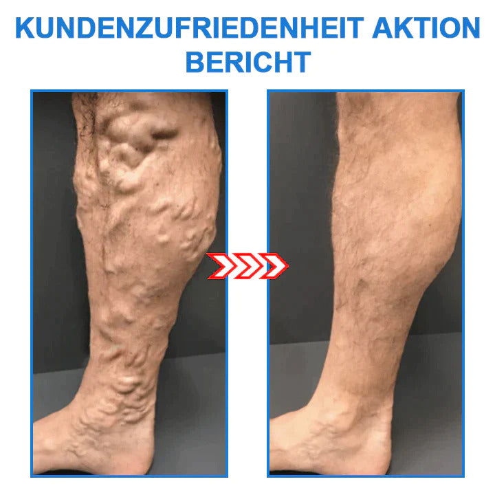 FormSocken™ - Jambes élancées et peau ferme en un seul geste !