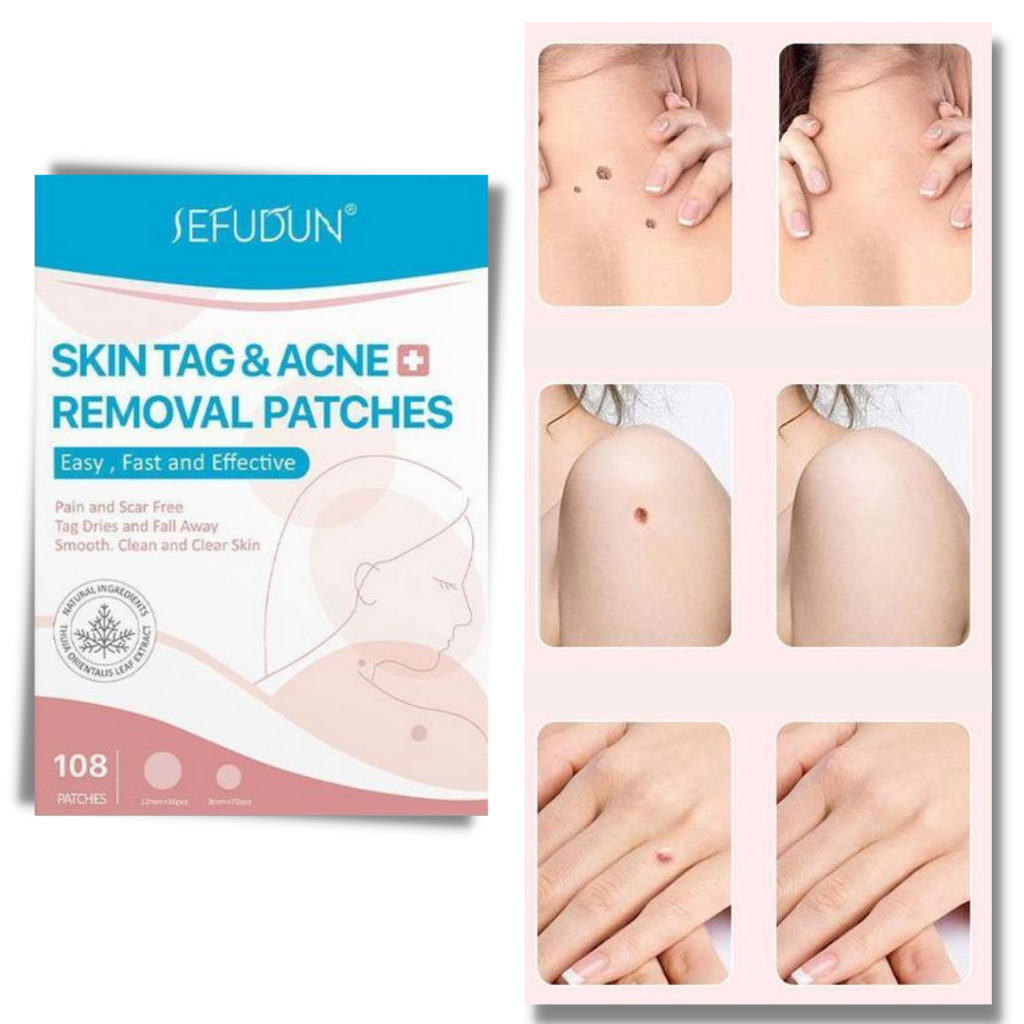 Skanto | Patch cutané - Éliminez les grains de beauté et les verrues de manière naturelle !