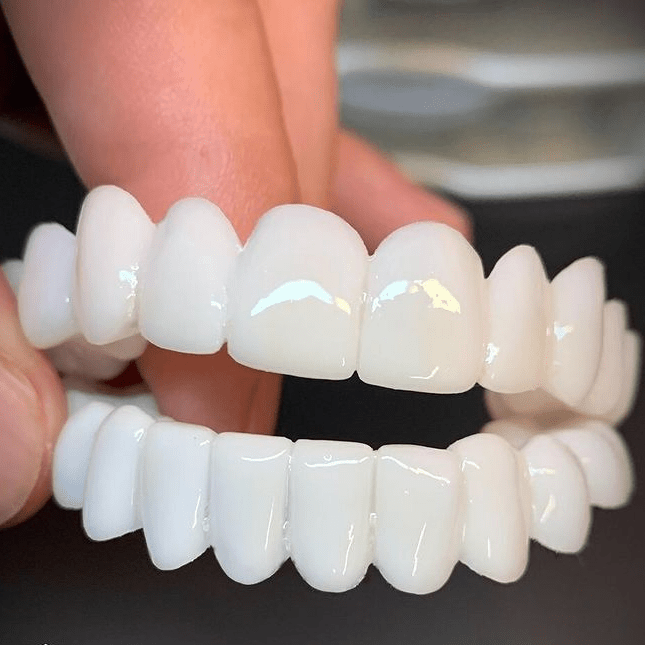 SMILEFLEX – Prothèse dentaire avec lentilles dentaires blanches