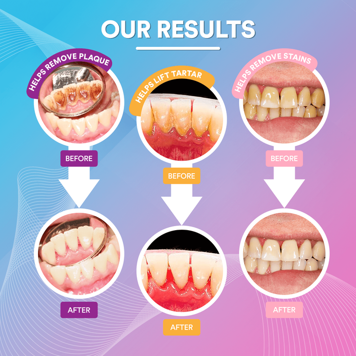 CrispSmile™ — Révélez Instanément un Sourire Éclatant et Soigneux Qui Fait Tourner les Têtes