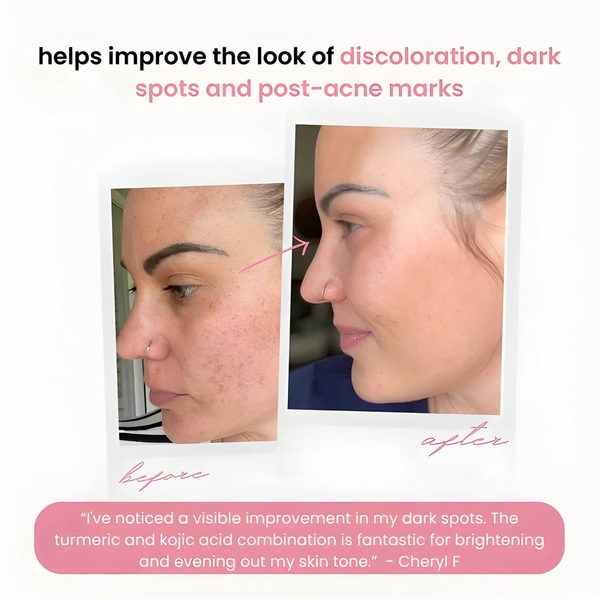 CleanPro™ — Révélez votre éclat radieux en estompant rapidement les taches sombres