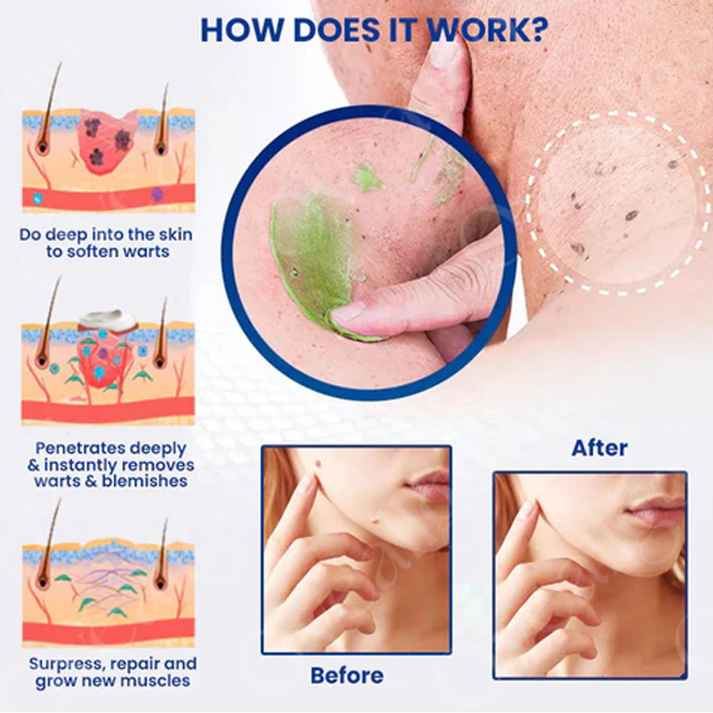 ClearVanta™ Crème Éclaircissante Rapide — Révélez une Peau Radieuse et Parfaite Sans Douleur ni Chirurgie