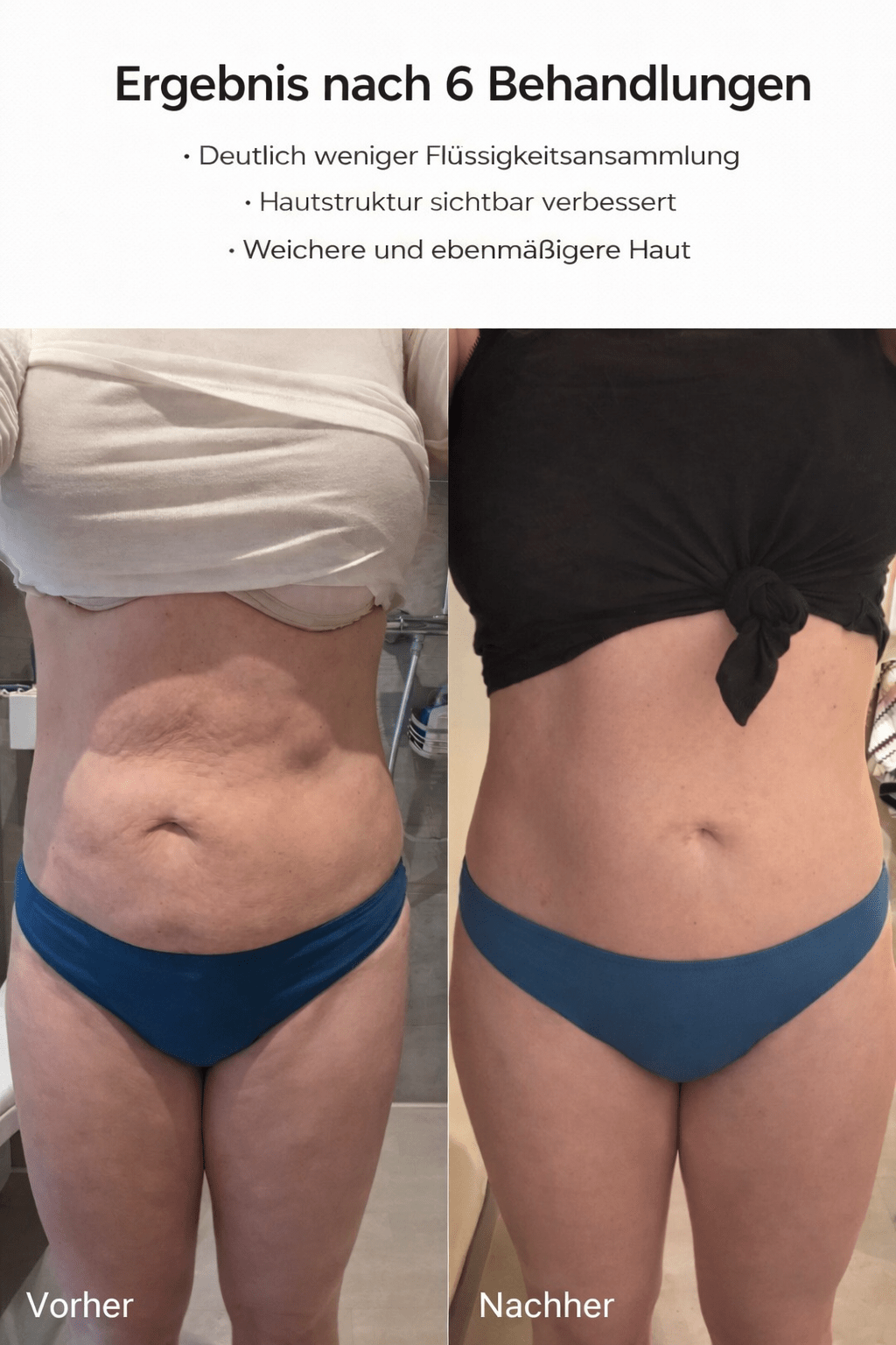 Celluviaa – peau lisse en 14 jours