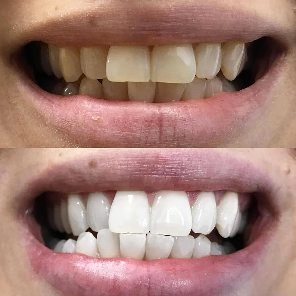 RadianceRush™ — Illuminez Chaque Pièce avec un Sourire Qui Rayonne de Confiance