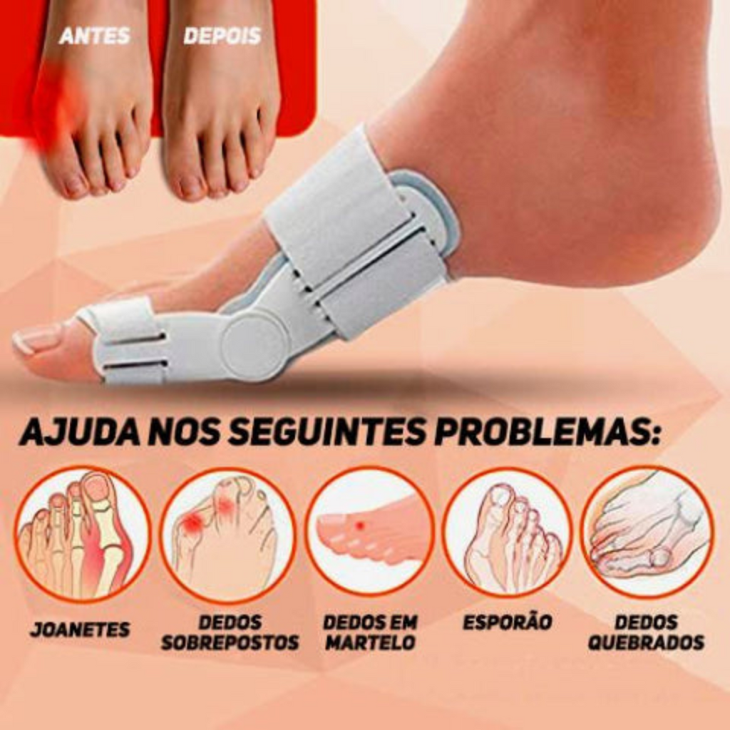 AlignaStep™ — Mettez fin à la douleur des oignons et avancez en toute confiance vers le confort