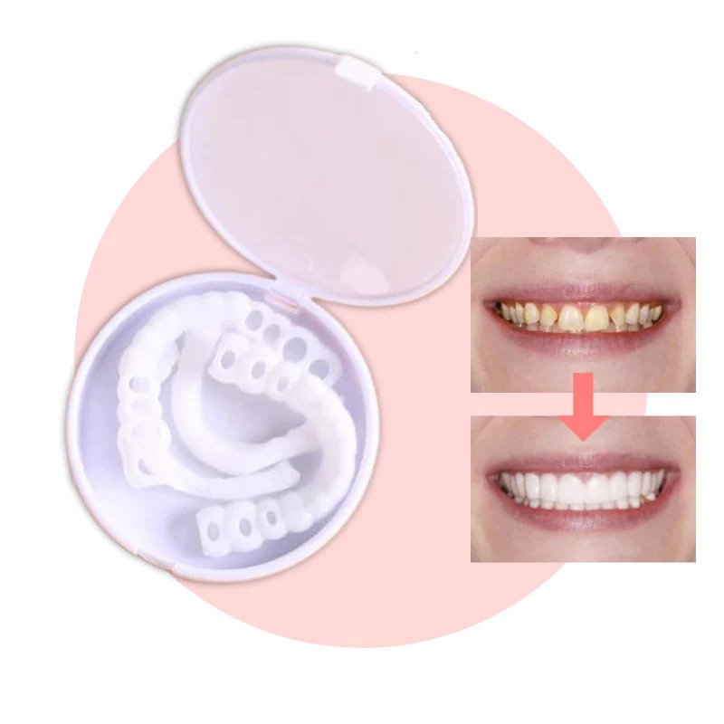 Snap-on Dents™ - Avec ces facettes, obtenez toujours le sourire parfait