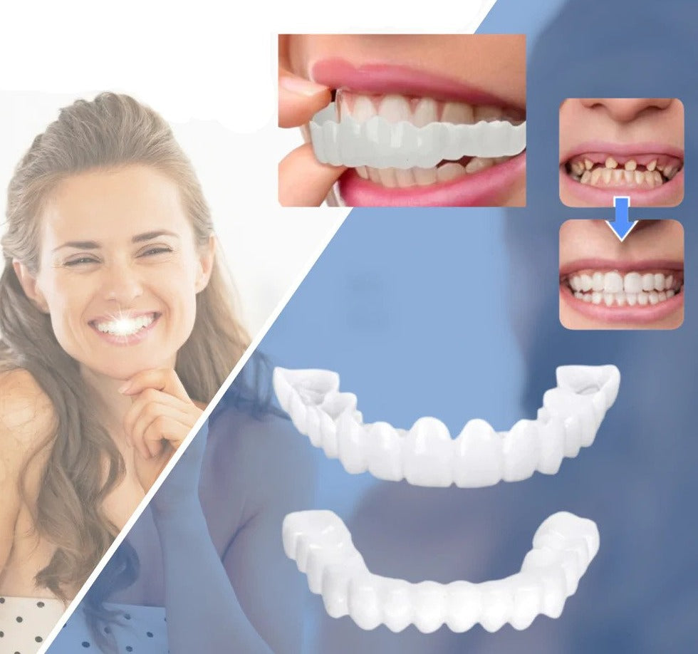 Snap-on Dents™ - Avec ces facettes, obtenez toujours le sourire parfait