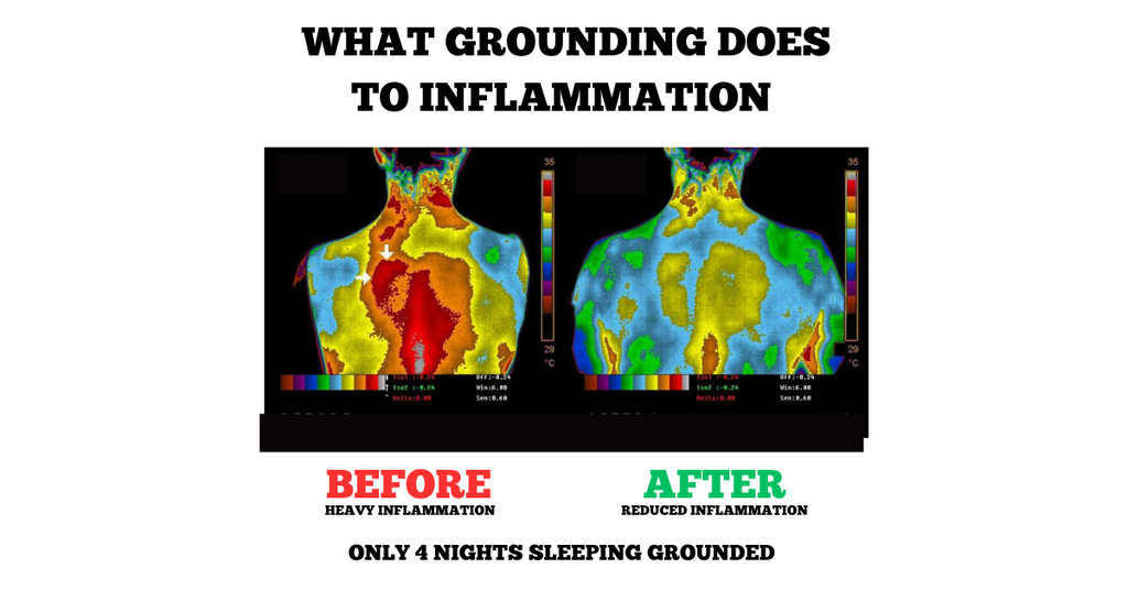 Tapis de Sommeil de Mise à la Terre - Qualité de Sommeil Améliorée