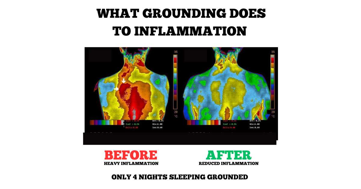 Tapis de Sommeil de Mise à la Terre - Qualité de Sommeil Améliorée