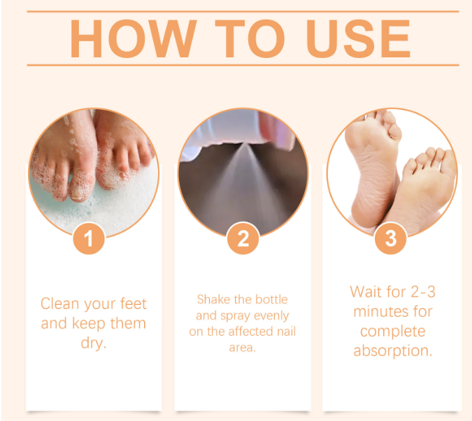 NailSpray 1+1 GRATUIT - Facile à Utiliser Spray Réparateur Apaisant pour les Ongles