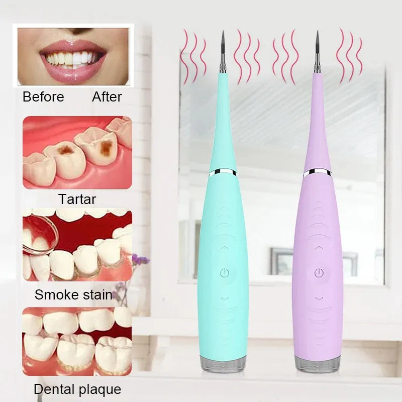 CrispSmile™ — Révélez Instanément un Sourire Éclatant et Soigneux Qui Fait Tourner les Têtes