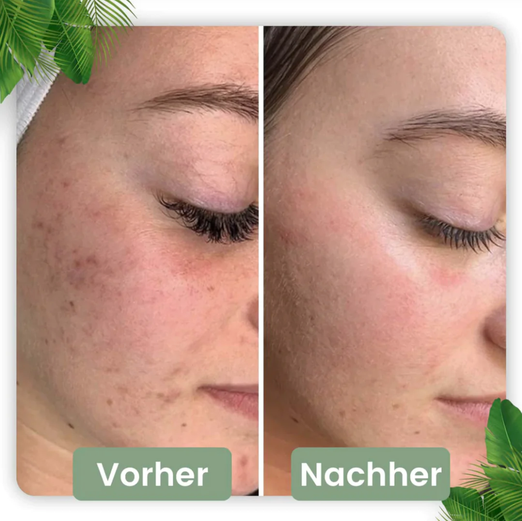 Bâtonnet de Nettoyage Profond pour une Peau Radieuse | Infusion Naturelle de Thé Vert