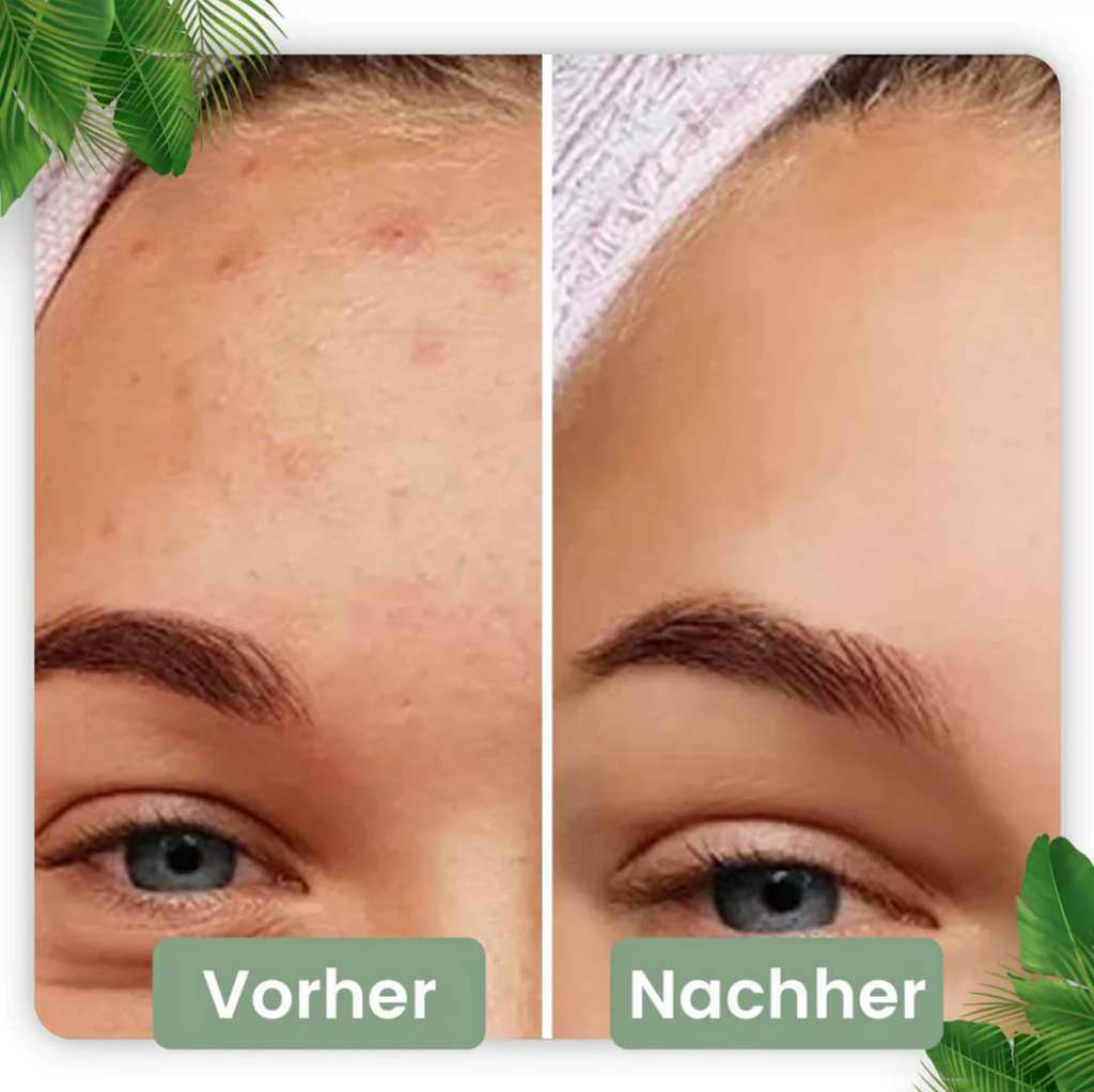 Bâtonnet de Nettoyage Profond pour une Peau Radieuse | Infusion Naturelle de Thé Vert