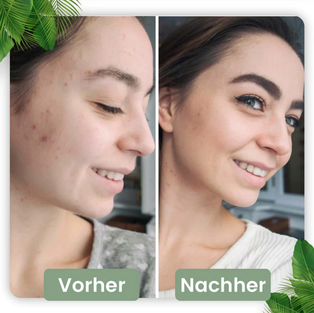 Bâtonnet de Nettoyage Profond pour une Peau Radieuse | Infusion Naturelle de Thé Vert