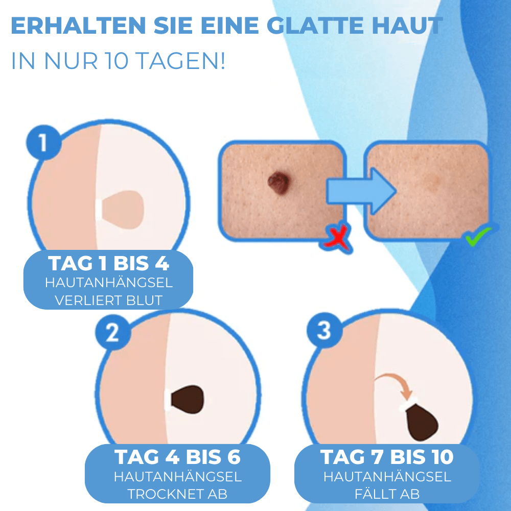Set d'Élimination des Verrues et des Grands Grains de Beauté
